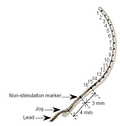 Figure 1. The HiFocus electrode consists of a fantail, electrode lead and electrode array on which  