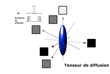 Représentation du tenseur de diffusion (http://www.e-mri.org/fr/)