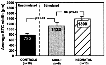 Figure 70. Largeur des courbes d’accord (spatial tuning curve, STC) générées chez les chats sourds non implantés, les chats implantés une fois adultes et les chats implantés très jeunes (Leake et coll., 2000).