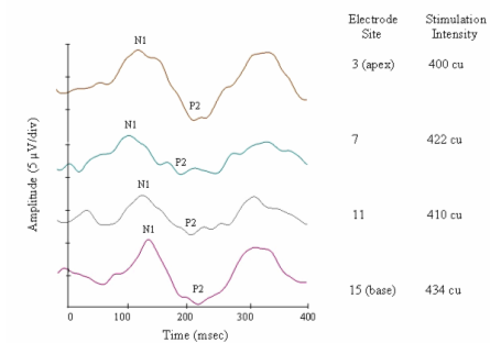 Figure 1. N1-P2 responses recorded from Subject 12 on electrodes 3, 7, 11, and 15 at comfortably loud intensity. N1 and P2 are indicated. CU: Current Unit (proportional to microamperes). Negativity is up.