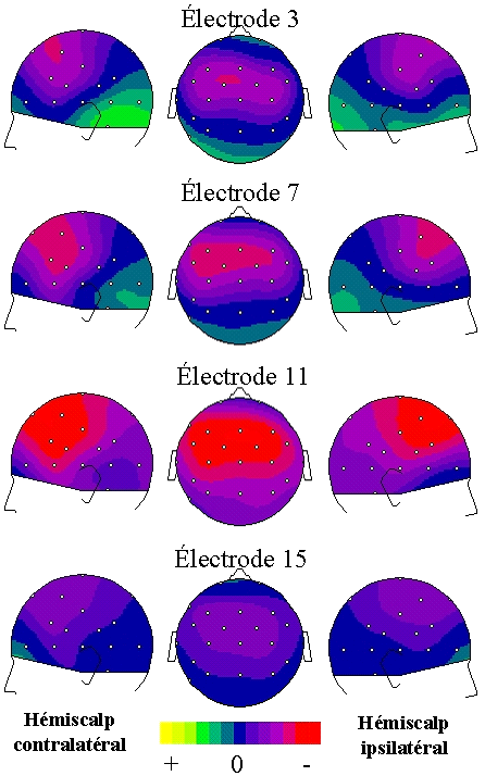 Figure 55. Grande moyenne des topographies de la réponse évoquée N1 enregistrée dans les premiers jours d’utilisation de l’implant cochléaire (entre le J0 et 3 jours maximum) chez huit personnes en réponse à la stimulation de quatre électrodes. La latence (104 ms) correspond à l’amplitude maximale sur les électrodes de recueil en mastoïde M1 (contralatéral) et M2 (ipsilatéral). L’échelle de couleur est de ± 1.6 µV. La localisation des électrodes de recueil sur le scalp est représentée les points blancs.