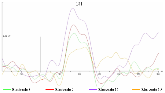 Figure 54. Potentiels évoqués inter-moyennés enregistrés en Fz pour l’activation des électrodes 3 (apicale), 7, 11 et 15 (basale).