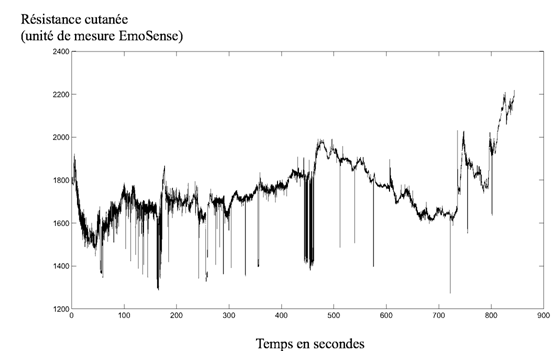 Figure 50 : Exemple de tracé d’activité électrodermale difficilement lisible