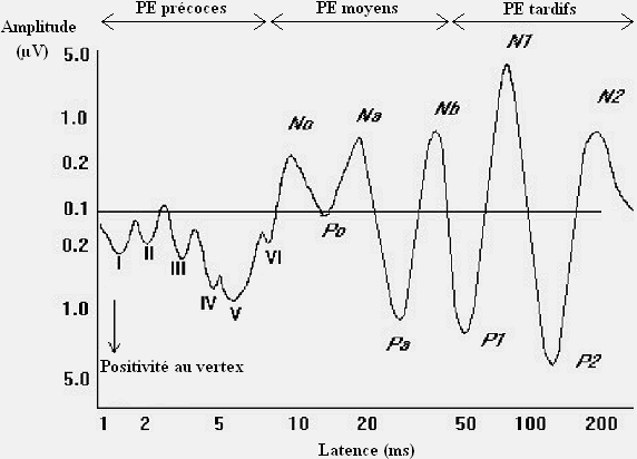 Figure 40. Décours temporel (échelle logarithmique) et différentes composantes des potentiels évoqués auditifs de perception.