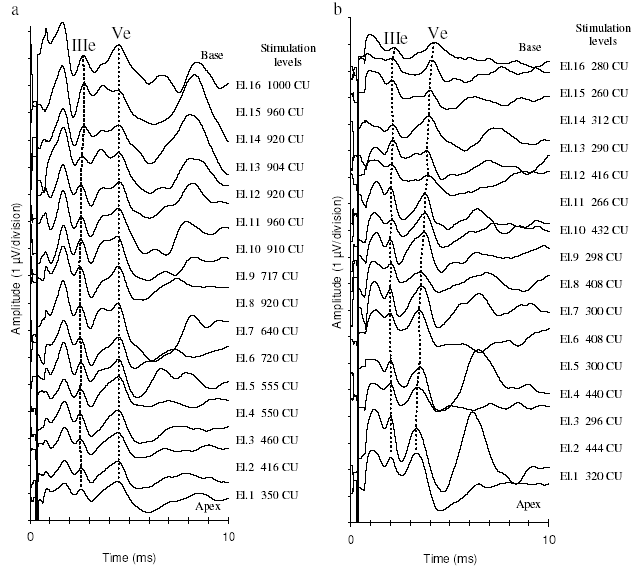 Figure 5. EABR waveforms for all electrodes stimulated at a comfortably loud intensity in two subjects. The stimulation site seems to have no effect on waves IIIe and Ve latencies of Subject 2 (figure a). In Subject 4 (figure b), the latencies of waves IIIe and Ve decrease for more apical stimulation sites. The etiologies were perinatal asphyxia for Subject 2 whose deafness last 17 years and stroke for Subject 4 whose deafness last 5 years. The intensities of stimulation expressed in clinical units (CU) are indicated next to the electrode of stimulation.