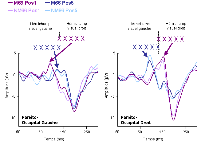 Figure 4.12 : PE mesurés dans les régions pariéto-occipitales gauche et droite, pour les deux contextes lexicaux Mot et Non-mot et les positions de lettres 1 et 5 (TP de 66 ms). Les conditions expérimentales correspondant aux deux positions de regard sont schématisées en haut de la figure, afin de mettre en évidence le délai de l’onde P1 dans l’hémisphère gauche pour la position 5 de regard, et le délai dans l’hémisphère droit pour la première position de regard.