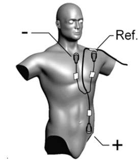 Figure 39 : Illustration de la pose des électrodes sur le torse