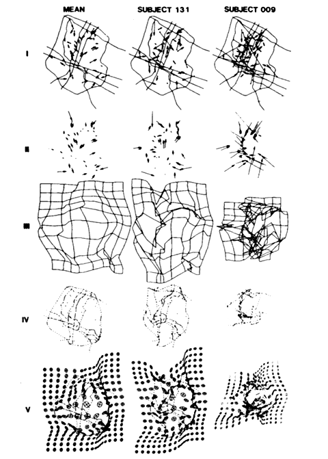 Figure 46 : Exemples de représentations pseudo-cartographiques de cartes mentales
