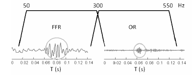 Figure 3 : Séparation de l’OR de la FFR fréquentiellement, la trace temporelle en bas montre les différences temporelles pour l’OR et la FFR. 