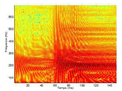 Figure 38 : Représentation spectrographique de l’onset response après application de la seconde méthode d’analyse.