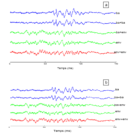 Figure 41 : Représentation temporelle des grandes moyennes en réponse aux différents stimuli.