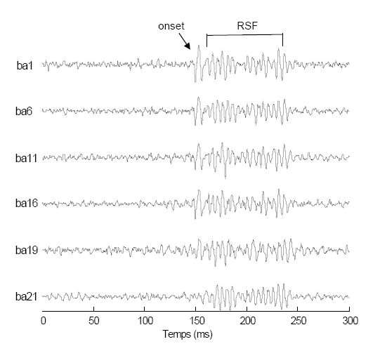 Figure 47 : Représentation temporelle des traces PEASP en réponse aux différents stimuli.