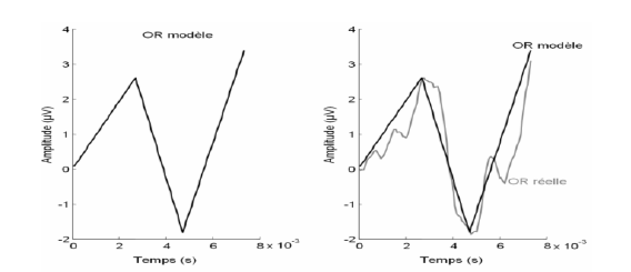 Figure 36 : Modélisation de la l’onset response.