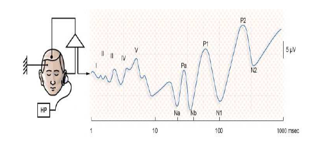 Figure 10 : Schéma de référence des voies auditives permettant de repérer le site anatomique des différentes ondes du PEA. 