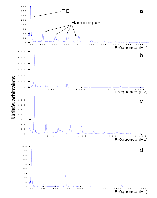 Figure 16 a,b,c,d: Représentation fréquentielle des stimuli langagiers et non langagiers.