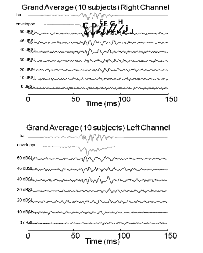 Fig. 1a and b: Grand-average traces of speech ABR recorded in 10 normally hearing subjects. The two top traces represent the /ba/ stimulus and its envelope. The SABR are ordered by stimulation intensities, from top to bottom. The stimulation was monaural (right ear), and the traces have been recorded on the right channel (fig. 1a) and on the left channel (fig. 1b).