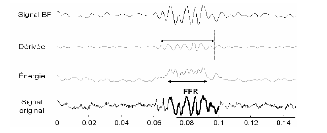 Figure 35 : Illustration de la première technique utilisée pour localiser temporellement la RSF (réponse soutenue en fréquence, ou FFR).