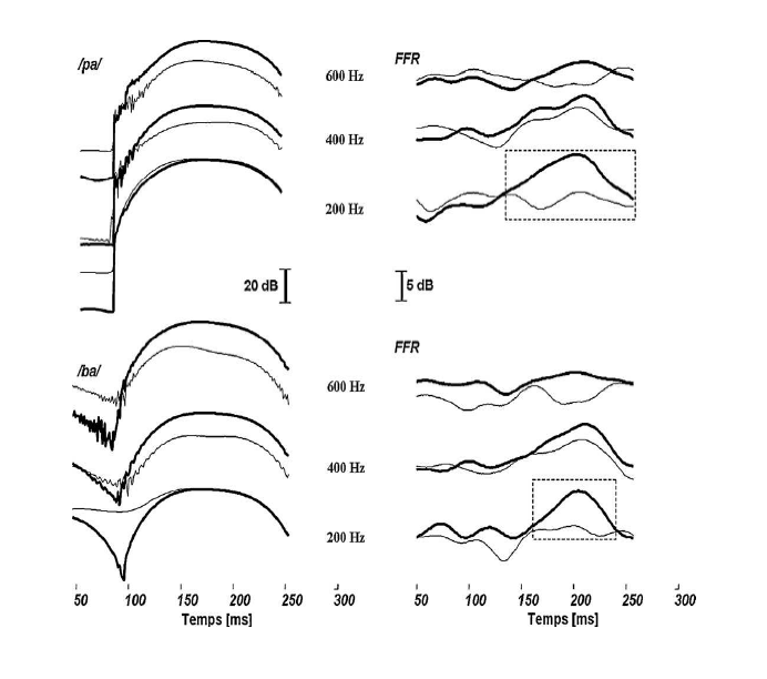 Figure 22 : Tirée de Akhoun et al, 2008 : Comparaison des coupes des spectrogrammes à différentes bandes de fréquences : F0 (200 Hz) et aux deux premiers harmoniques (400 et 600 Hz). 