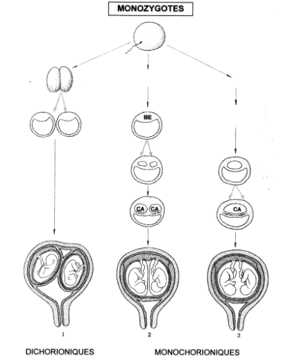Figure 7. Annexes des grossesses monozygotiques