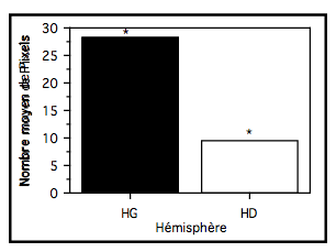 Figure 23. Représentation du nombre de pixels activés au sein des gyri angulaires dans l'examen "catégoriel". L'astérisque représente une différence hémisphérique significative (p<.05)