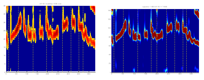 Figure 5.14 Représentation de la prosodie, à gauche par des filtres Mel (suppression des valeurs inférieures à 35), à droite par un spectrogramme à bande étroite.