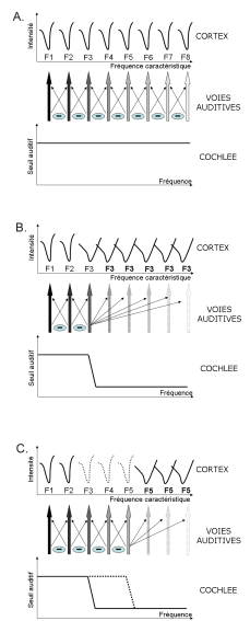 Figure 36 : Représentation schématique des fréquences caractéristiques des neurones de A1 chez un sujet sain (A), un sujet malentendant présentant une perte abrupte aux hautes fréquences (B) et un sujet malentendant appareillé (C). 