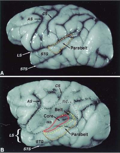 Figure 12 : Vue latérale du cortex du macaque. 