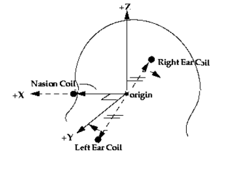 Figure 35 : Localisation des coudes et orientation des axes dans un enregistrement MEG.