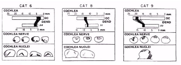 Figure 6 : Relations tonotopiques existant entre l’organe de Corti (OC), le ganglion spiral (SG), le nerf auditif (cochlea nerve) et les noyaux cochléaires. Selon la partie lésée de la cochlée, des zones de dégénérescence apparaissent dans des zones bien spécifiques du nerf auditif et du noyau cochléaire (Sando, 1965).
