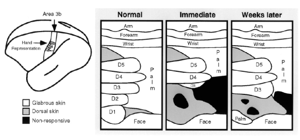 Figure 21 : Exemple de réorganisation du cortex somatosensoriel (aire 3b) chez des singes hiboux après la section du nerf médian responsable de l’innervation de la moitié de la paume de la main (dont le pouce). 