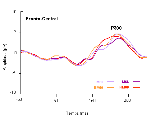 Figure 4.6 : PE mesurés dans la région fronto-centrale (dérivation linéaire des électrodes F1, FC1, Fz, FCz, F2, FC2), pour les deux contextes lexicaux Mot et Non-mot et les deux TP.
