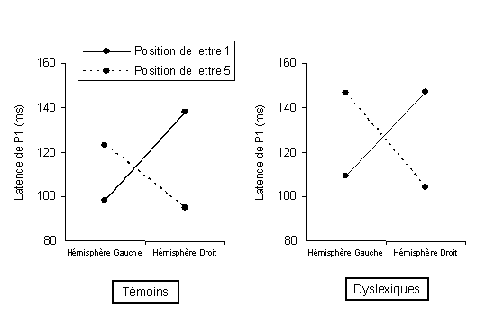 Figure 6.7 : Latences moyennes de P1 dans les deux hémisphères cérébraux, pour les positions de lettres 1 et 5. Le graphique illustre la forte interaction existant entre les deux facteurs de position et d’hémisphère, pour les sujets témoins (