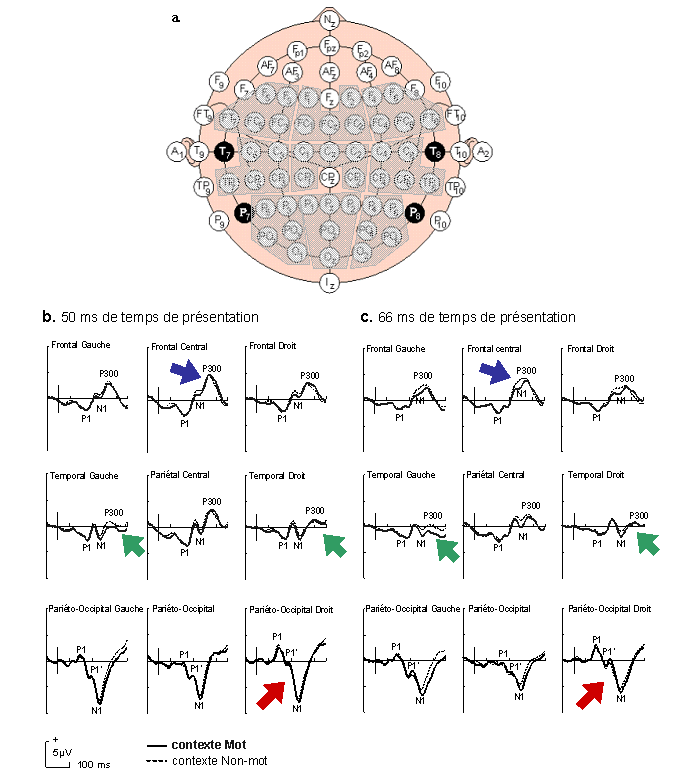 Figure 4.4 : Résultats de Potentiels Evoqués pour 9 régions principales du scalp (Frontal Gauche ; Frontal Central ; Frontal Droit ; Temporal Gauche ; Pariétal Central ; Temporal Droit ; Pariéto-Occipital Gauche ; Pariéto-Occipital ; Pariéto-Occipital Droit). 