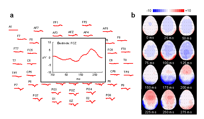 Figure 3.4 : Visualisation des Potentiels Evoqués. 